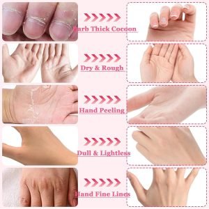 Deep Moisturizing Gloves for Dry Hands, Nail & Cuticle Softening
